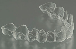 Bonded Retainer