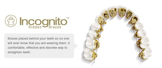 Incognito Lingual Braces Orthodontist Dublin